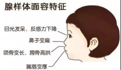 重庆仁品耳鼻喉专家—腺样体肥大有哪些症状？