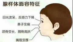 重庆耳鼻喉-小儿腺样体肥大是哪些刺激物造成的