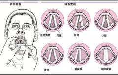 耳鼻喉哪个医院好_引发声音嘶哑的病因有哪些呢