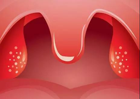 重庆扁桃体炎如何预防