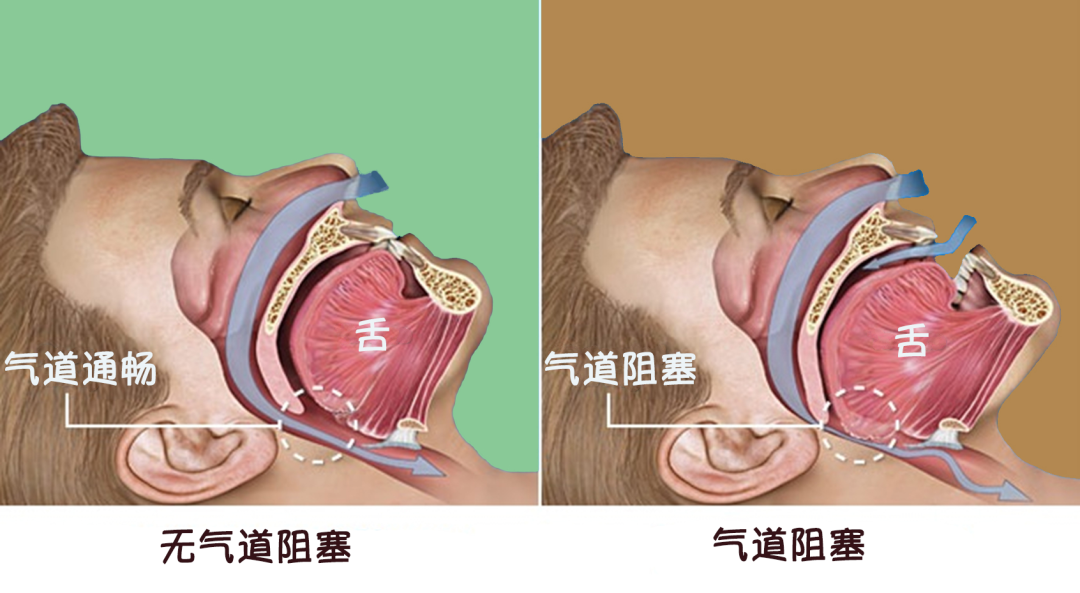 重庆咽喉科医院