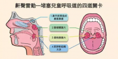 儿童扁腺术后饮食：重庆仁品耳鼻喉医院的详细指导